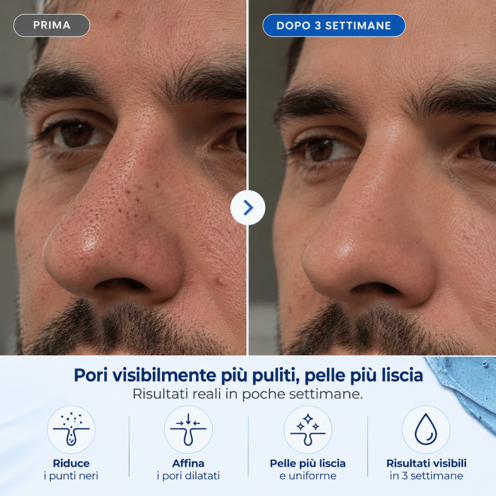 Maschera Zero Pori & Punti Neri Brilla Skin™